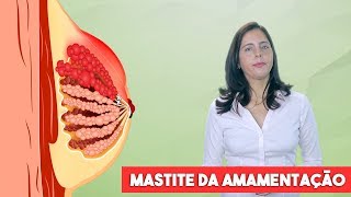 Mastite durante a amamentação mastite lactacional [upl. by Vivie]