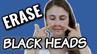 Erase blackheads dermatologist tips Dr Dray [upl. by Marijane]