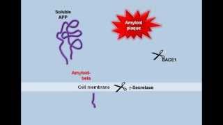 Plaque Formation in the Alzheimers Brain [upl. by Ontine]