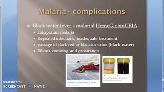 Parasitology 075 i Plasmodium Falciparum Malaria Complication Malignant black water fever algid [upl. by Kirtley]