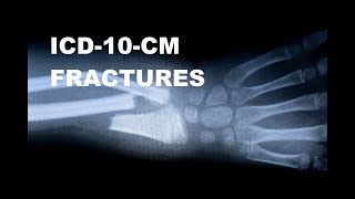 ICD10CM Coding for Fractures [upl. by Giffard376]