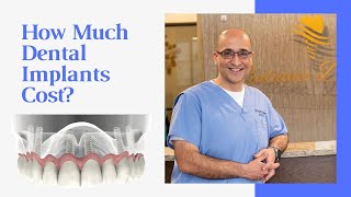 How much dental implants cost [upl. by Burt]