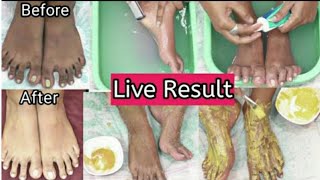 Feet Whitening Pedicure At Home  Remove Suntan amp Whiten Your Skinkanmani beauty tips [upl. by Ainod]