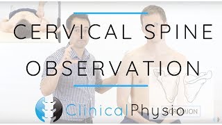 Cervical Spine Observation  Clinical Physio Premium [upl. by Artenal408]