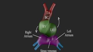 Aortic Branches  Cardiology [upl. by Devondra]