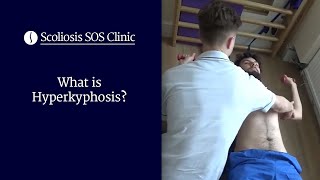 What is Hyperkyphosis  Scheuermanns Disease amp Bad Posture [upl. by Aubert]