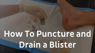 How To Puncture And Drain A Blister  Blister Treatment [upl. by Alekal]