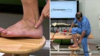 Tratamiento de la tendinitis de los peroneos  Fisioterapia Bilbao [upl. by Nemlaz]