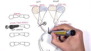 Visual Pathway and Lesions [upl. by Reppiks]