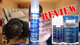 What I Wish I Knew Before Starting Minoxidil for Beard Growth [upl. by Nnayelsel]