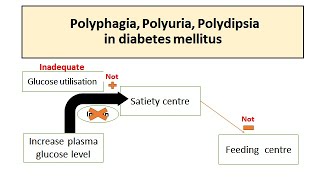 Polyuria Polyphagia Polydipsia in Diabetes mellitus [upl. by Eecak]