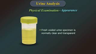 Urine Analysis [upl. by Betthezul491]