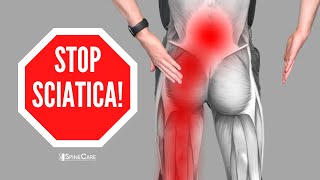 How to Relieve Sciatica Pain in SECONDS [upl. by Rasaec]