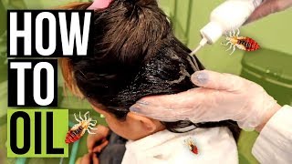 Top 5 Home Remedies To Get Rid Of Head LICE amp Nits  Sushmitas Diaries [upl. by Guzel]