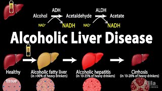 Alcoholic Liver Disease Animation [upl. by Harland394]