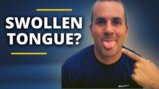 SWOLLEN TONGUE Enlarged Tongue  Symptoms and How To Heal Peripheral Neuropathy [upl. by Jacquet]