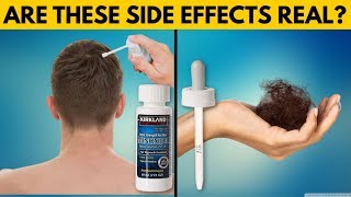 REAL TRUTH About Minoxidil Side Effects [upl. by Elacim208]