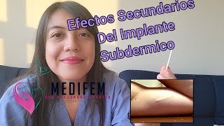 Efectos Secundarios del Implante Subdermico Jadelle implanon nexplanon [upl. by Studner]