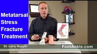 Metatarsal Stress Fractures  How to Diagnose Yourself [upl. by Oflodor]