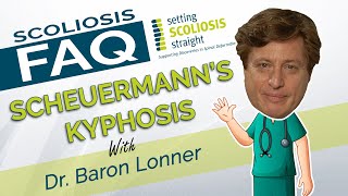 Scoliosis FAQ  Scheuermanns Kyphosis [upl. by Airom207]