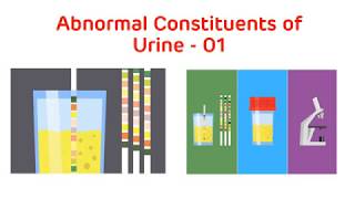 Analysis of Abnormal Urine  Abnormal Urine Constituents Practical Part I  Biochemistry Practical [upl. by Aniat]