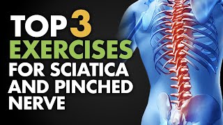 Top 3 Exercises for Sciatica and Pinched Nerve [upl. by Sidalg367]