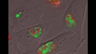 Pathophysiology of chlamydia  Infectious diseases  NCLEXRN  Khan Academy [upl. by Fish669]