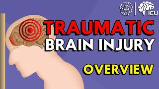 Overview of Traumatic Brain Injury TBI [upl. by Nytsud]