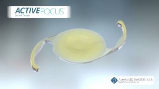 Alcon Activefocus Restor 25 Multifocal Intraocular Lens [upl. by Etnahsal]