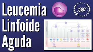 Leucemia Linfoide Aguda Explicada Claramente [upl. by Aigil]