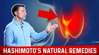 Dr Izabella Wentz Three Most Helpful Nutrients for Hashimotos [upl. by Retsub915]