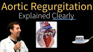 Aortic Regurgitation Insufficiency Explained Clearly [upl. by Forster283]