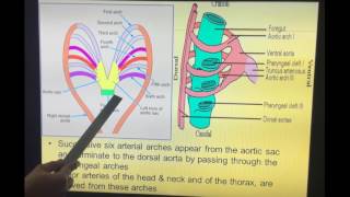 Truncus Arteriosus Causes Signs and Symptoms DIagnosis and Treatment [upl. by Isdnyl]