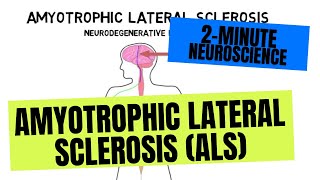 Internal Rotation Lag Sign  Subscapularis Tear [upl. by Gide766]