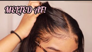 How to RE Install Frontal Wigs for Beginners  VERY DETAILED  Melt Transparent Lace [upl. by Sapphire]