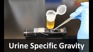 Urine Specific Gravity Refractometer [upl. by Enyalaj537]