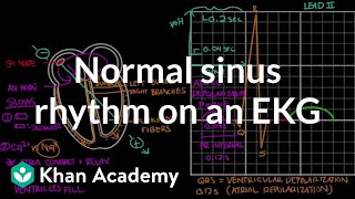 Normal sinus rhythm on an EKG  Circulatory System and Disease  NCLEXRN  Khan Academy [upl. by Hcirteid]