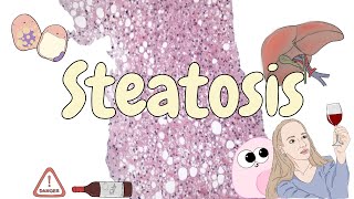 Steatosis  liver pathology [upl. by Wolenik]