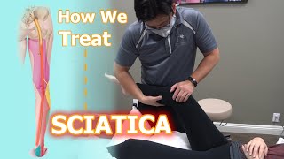 How We Treat Sciatica  Physical Therapy [upl. by Sukramed]