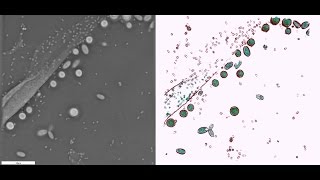 Contaminated cell culture [upl. by Bibi213]