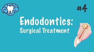 Endodontics  Surgical Treatment  INBDE ADAT [upl. by Anatnahs14]