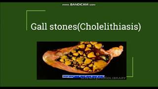 Cholelithiasis  Gallstones Pathogenesis amp Morphology [upl. by Annmaria]