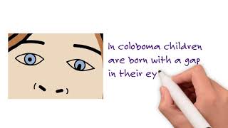 Microphthalmia Anophthalmia and Coloboma [upl. by Lennard]