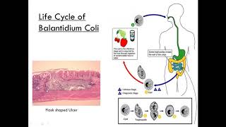 Balantidium Coli Class Ciliate Parasitology [upl. by Gauntlett]