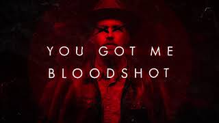 Sam Tinnesz  Bloodshot Official Lyric Video [upl. by Mccready]