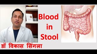 Functions of Liver Simple explaination in Hindi  Bhushan Science [upl. by Alex832]