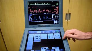 The basics of intraaortic balloon pump IABP [upl. by Elsi]