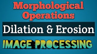 Dilation and Erosion in Digital Image Processing  Morphological Operations in Image Processing AKTU [upl. by Lerud]