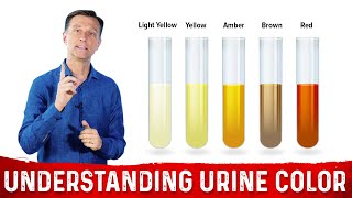 What Urine Color Indicates About Your Body – DrBerg [upl. by Silra433]