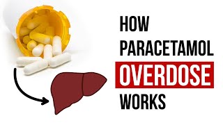 How Paracetamol Overdose Works [upl. by Ailemaj]